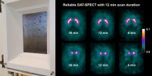 Dopamine Transporter SPECT with 12-Minute Scan Duration Using Multiple-Pinhole Collimators