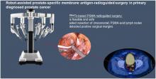 Robot-Assisted Prostate-Specific Membrane Antigen–Radioguided Surgery in Primary Diagnosed Prostate Cancer