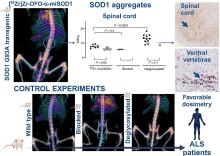 Antibody-Based PET Imaging of Misfolded Superoxide Dismutase 1 in an Amyotrophic Lateral Sclerosis Mouse Model