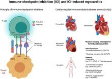 Imaging the Inflammatory Response in Checkpoint Inhibition Myocarditis