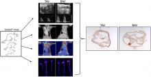 Multimodality Imaging of Aortic Valve Calcification and Function in a Murine Model of Calcific Aortic Valve Disease and Bicuspid Aortic Valve