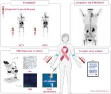 Phase II Trial Assessing the Repeatability and Tumor Uptake of [<sup>68</sup>Ga]Ga-HER2 Single-Domain Antibody PET/CT in Patients with Breast Carcinoma