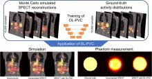 A Deep-Learning–Based Partial-Volume Correction Method for Quantitative <sup>177</sup>Lu SPECT/CT Imaging