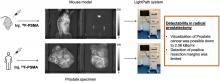 <sup>18</sup>F-PSMA Cerenkov Luminescence and Flexible Autoradiography Imaging in a Prostate Cancer Mouse Model and First Results of a Radical Prostatectomy Feasibility Study in Men