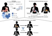 <sup>18</sup>F-BMS-986229 PET to Assess Programmed-Death Ligand 1 Status in Gastroesophageal Cancer