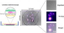 Development of a Lensless Radiomicroscope for Cellular-Resolution Radionuclide Imaging