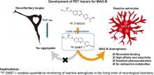 <sup>18</sup>F-SMBT-1: A Selective and Reversible PET Tracer for Monoamine Oxidase-B Imaging