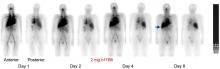 A Phase 0 Study to Assess the Biodistribution and Pharmacokinetics of a Radiolabeled Antibody Targeting Human Kallikrein 2 in Participants with Metastatic Castration-Resistant Prostate Cancer