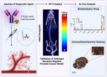 CEACAM5-Targeted Immuno-PET in Androgen Receptor–Negative Prostate Cancer