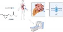 Diagnostic Performance of <sup>124</sup>I-Metaiodobenzylguanidine PET/CT in Patients with Pheochromocytoma