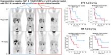 Comparison of Baseline <sup>68</sup>Ga-FAPI and <sup>18</sup>F-FDG PET/CT for Prediction of Response and Clinical Outcome in Patients with Unresectable Hepatocellular Carcinoma Treated with PD-1 Inhibitor and Lenvatinib