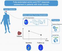 Automated Brain Tumor Detection and Segmentation for Treatment Response Assessment Using Amino Acid PET