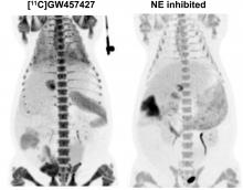 PET Imaging of Neutrophil Elastase with <sup>11</sup>C-GW457427 in Acute Respiratory Distress Syndrome in Pigs