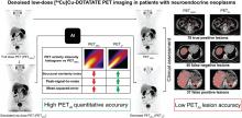 An Investigation of Lesion Detection Accuracy for Artificial Intelligence–Based Denoising of Low-Dose <sup>64</sup>Cu-DOTATATE PET Imaging in Patients with Neuroendocrine Neoplasms