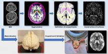 StepBrain: A 3-Dimensionally Printed Multicompartmental Anthropomorphic Brain Phantom to Simulate PET Activity Distributions