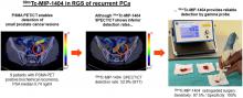 Feasibility of <sup>99m</sup>Tc-MIP-1404 for SPECT/CT Imaging and Subsequent PSMA-Radioguided Surgery in Early Biochemically Recurrent Prostate Cancer: A Case Series of 9 Patients