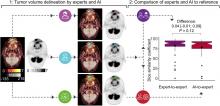 Clinical Evaluation of Deep Learning for Tumor Delineation on <sup>18</sup>F-FDG PET/CT of Head and Neck Cancer