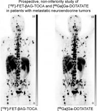 Somatostatin Receptor Imaging with [<sup>18</sup>F]FET-βAG-TOCA PET/CT and [<sup>68</sup>Ga]Ga-DOTA-Peptide PET/CT in Patients with Neuroendocrine Tumors: A Prospective, Phase 2 Comparative Study