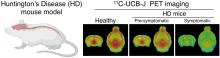 Synaptic Vesicle Glycoprotein 2A Is Affected in the Central Nervous System of Mice with Huntington Disease and in the Brain of a Human with Huntington Disease Postmortem