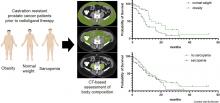 Elevated Body Mass Index Is Associated with Improved Overall Survival in Castration-Resistant Prostate Cancer Patients Undergoing Prostate-Specific Membrane Antigen–Directed Radioligand Therapy