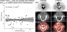 [<sup>18</sup>F]Fluorthanatrace PET in Ovarian Cancer: Comparison with [<sup>18</sup>F]FDG PET, Lesion Location, Tumor Grade, and Breast Cancer Gene Mutation Status