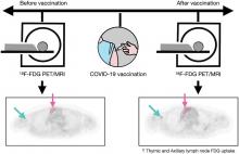 Increased Metabolic Activity of the Thymus and Lymph Nodes in Pediatric Oncology Patients After Coronavirus Disease 2019 Vaccination