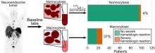 Elevated Baseline Mean Corpuscular Volume Predicts the Development of Severe Hematologic Toxicity After <sup>177</sup>Lu-DOTATATE Therapy