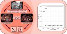 Tumor Characterization by [<sup>68</sup>Ga]FAPI-46 PET/CT Can Improve Treatment Selection for Pancreatic Cancer Patients: An Interim Analysis of a Prospective Clinical Trial