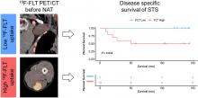 <sup>18</sup>F-FLT PET/CT as a Prognostic Imaging Biomarker of Disease-Specific Survival in Patients with Primary Soft-Tissue Sarcoma