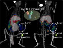 Dynamic Tumor-Specific MHC-II Immuno-PET Predicts the Efficacy of Checkpoint Inhibitor Immunotherapy in Melanoma