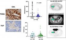 FAP and PSMA Expression by Immunohistochemistry and PET Imaging in Castration-Resistant Prostate Cancer: A Translational Pilot Study