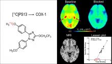 [<sup>11</sup>C]PS13 Demonstrates Pharmacologically Selective and Substantial Binding to Cyclooxygenase-1 in the Human Brain