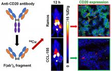 Noninvasive Evaluation of CD20 Expression Using <sup>64</sup>Cu-Labeled F(ab′)<sub>2</sub> Fragments of Obinutuzumab in Lymphoma