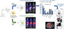 <sup>61</sup>Cu-PSMA–Targeted PET for Prostate Cancer: From Radiotracer Development to First-in-Human Imaging