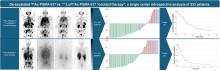 Deescalated <sup>225</sup>Ac-PSMA-617 Versus <sup>177</sup>Lu/<sup>225</sup>Ac-PSMA-617 Cocktail Therapy: A Single-Center Retrospective Analysis of 233 Patients