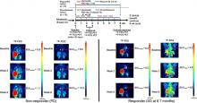 <sup>18</sup>F-Fluoroestradiol PET Imaging in a Phase II Trial of Vorinostat to Restore Endocrine Sensitivity in ER+/HER2− Metastatic Breast Cancer