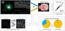 Glitter in the Darkness? Nonfibrillar β-Amyloid Plaque Components Significantly Impact the β-Amyloid PET Signal in Mouse Models of Alzheimer Disease