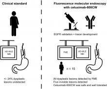 Detection of Early Esophageal Neoplastic Barrett Lesions with Quantified Fluorescence Molecular Endoscopy Using Cetuximab-800CW