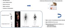 Performing [<sup>18</sup>F]MFBG Long–Axial-Field-of-View PET/CT Without Sedation or General Anesthesia for Imaging of Children with Neuroblastoma