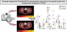 Oncologic Staging with <sup>68</sup>Ga-FAPI PET/CT Demonstrates a Lower Rate of Nonspecific Lymph Node Findings Than <sup>18</sup>F-FDG PET/CT