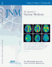 Journal of Nuclear Medicine: 45 (11)