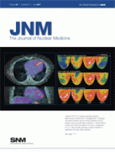 Journal of Nuclear Medicine: 48 (7)