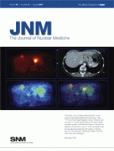 Journal of Nuclear Medicine: 48 (8)