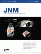 Journal of Nuclear Medicine: 49 (1)