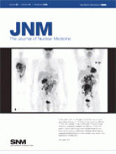 Journal of Nuclear Medicine: 49 (11)