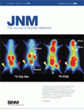 Journal of Nuclear Medicine: 49 (4)