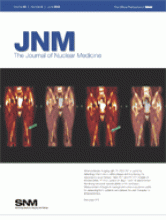 Journal of Nuclear Medicine: 49 (6)