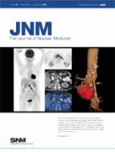 Journal of Nuclear Medicine: 49 (9)