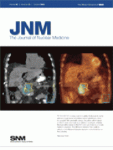 Journal of Nuclear Medicine: 50 (10)