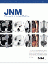 Journal of Nuclear Medicine: 51 (4)